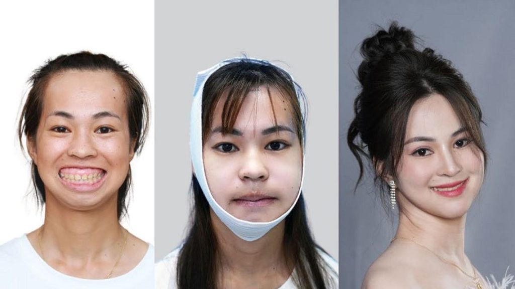 Hành Trình Lột Xác: 10 năm nỗ lực để các thí sinh Sống một đời rực rỡ