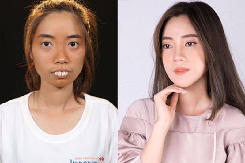 Sau khi tham gia chương trình các bạn trẻ đã có cơ hội thay đổi diện mạo và có cuộc sống tốt hơn