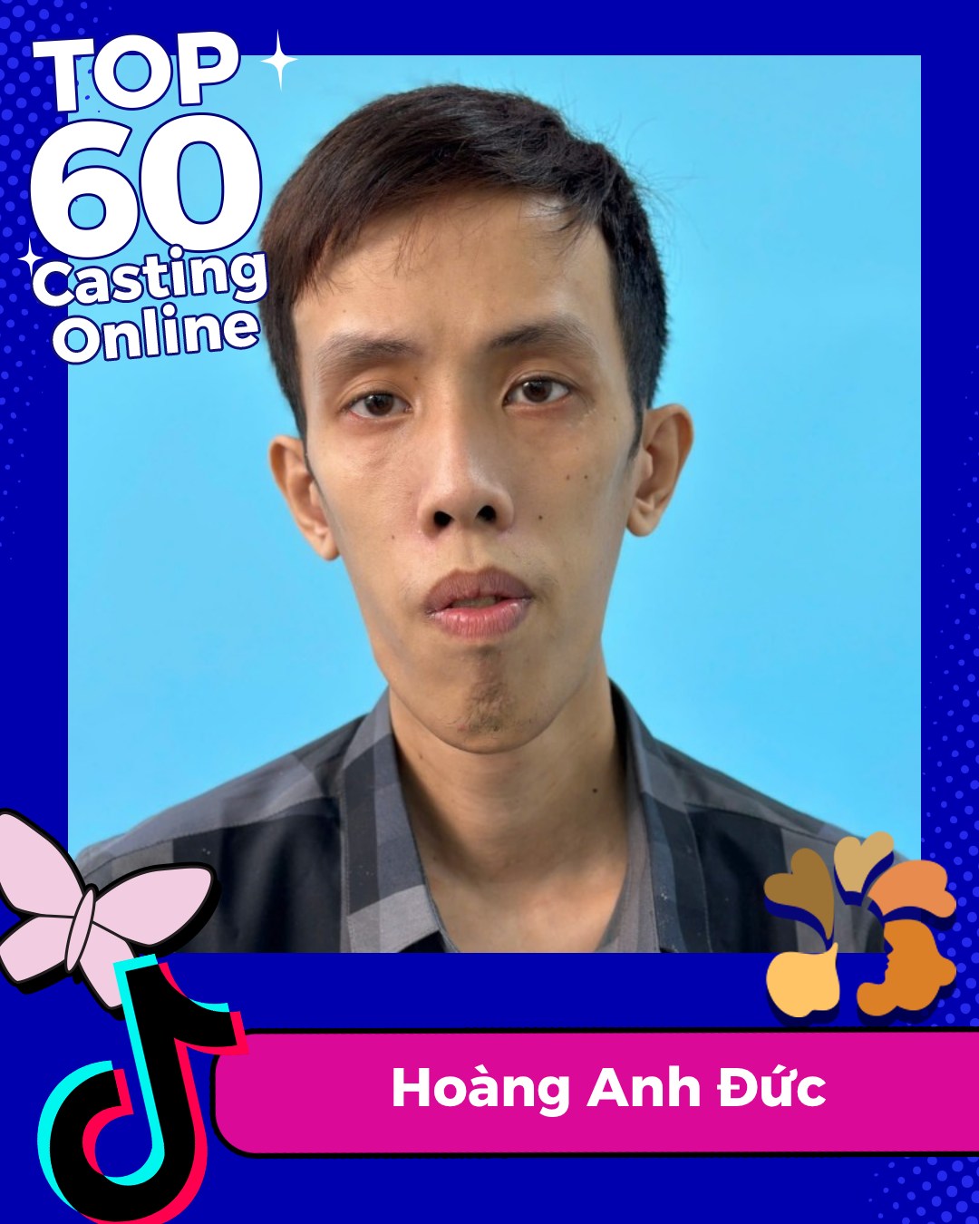 Thí sinh Anh Đức với tình trạng mặt hóp, hàm hô