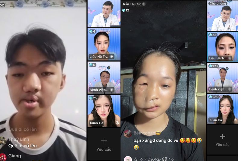 Nhiều thí sinh gặp khiếm khuyết phức tạp trong buổi casting online đầu tiên