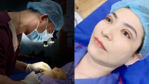 Cắt mí mắt có đau không? Những cách giảm đau hiệu quả