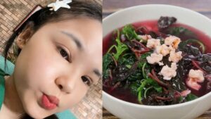 Cắt mí nên ăn gì cho mau lành? Thực phẩm giúp giảm sưng, nhanh hồi phục