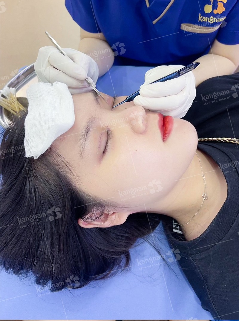 Sau 7 ngày khách hàng được cắt chỉ