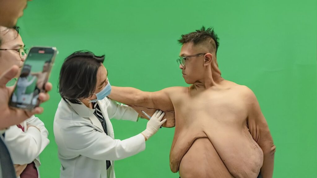 Hé lộ kế hoạch cắt da dư, tái tạo body cho Trọng Nhân tại Kangnam