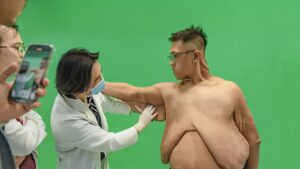 Hé lộ kế hoạch cắt da dư, tái tạo body cho Trọng Nhân tại Kangnam