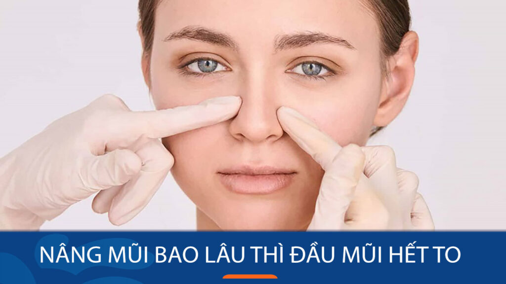 Nâng mũi bao lâu thì đầu mũi hết to? Thời gian hồi phục & cách chăm sóc