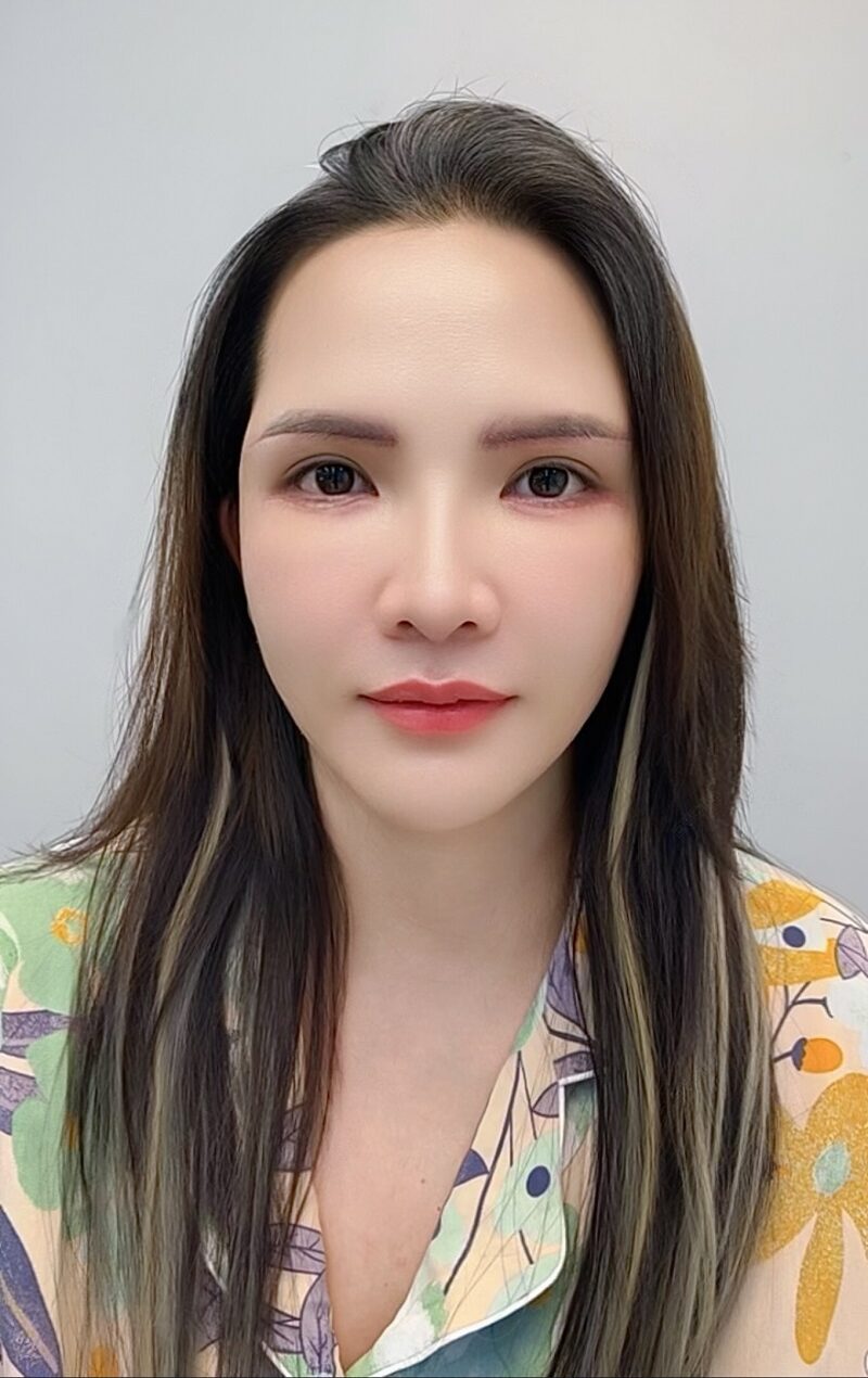 Sau khi thực hiện nâng cung mày, đôi mắt của chị Vân đã cân đối, trẻ trung hơn