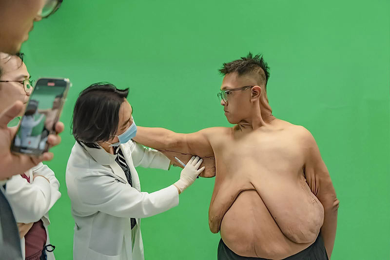 TS.BS Richard Huy trực tiếp khám cho Trọng Nhân