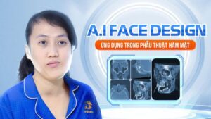 Công nghệ AI Face Design – Bước đột phá trong phẫu thuật hàm mặt hiện đại