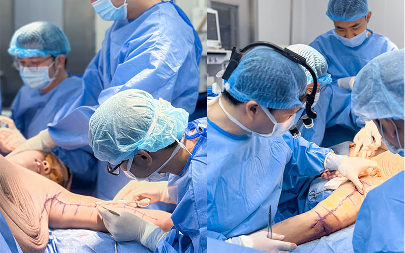 Lượng da thừa lớn, đòi hỏi bác sĩ thao tác tỉ mỉ