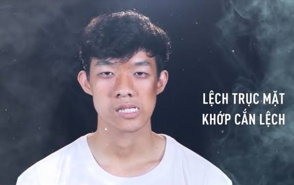 Tình trạng của Minh Hoàng là trường hợp tương đối khó 