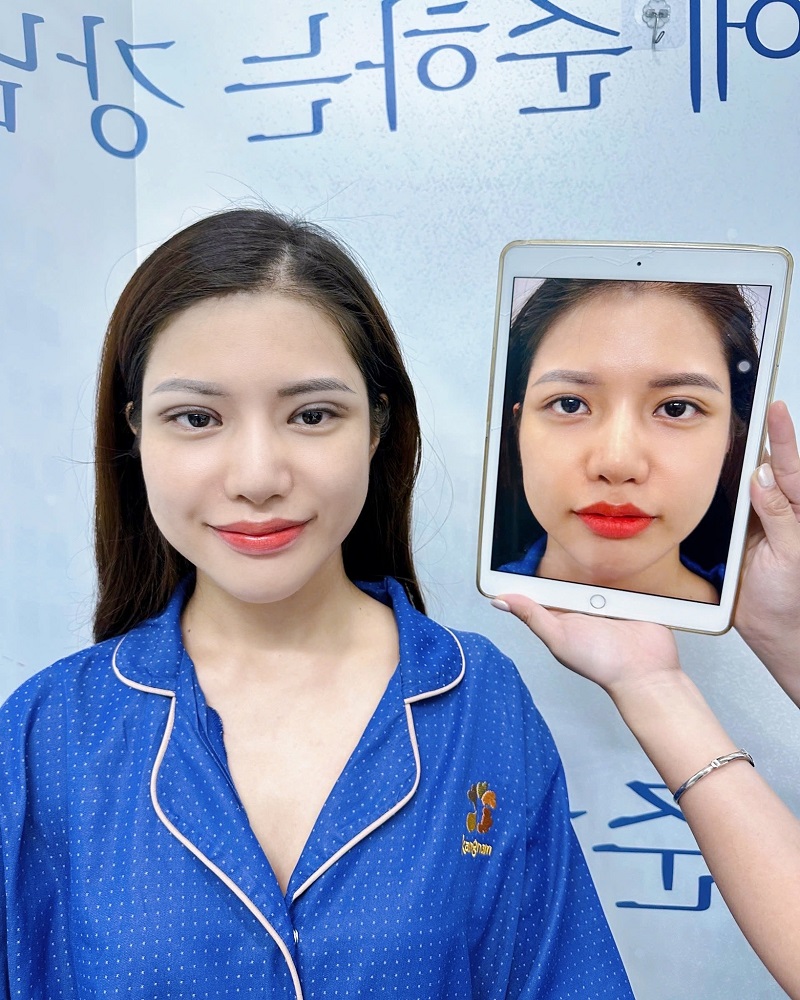 Nếp mí rõ nét, tôn nên đường nét xinh đẹp của Thảo