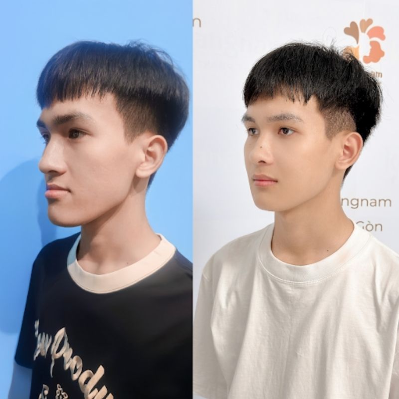 Áp dụng công nghệ 3D giúp tối ưu kết quả thẩm mỹ