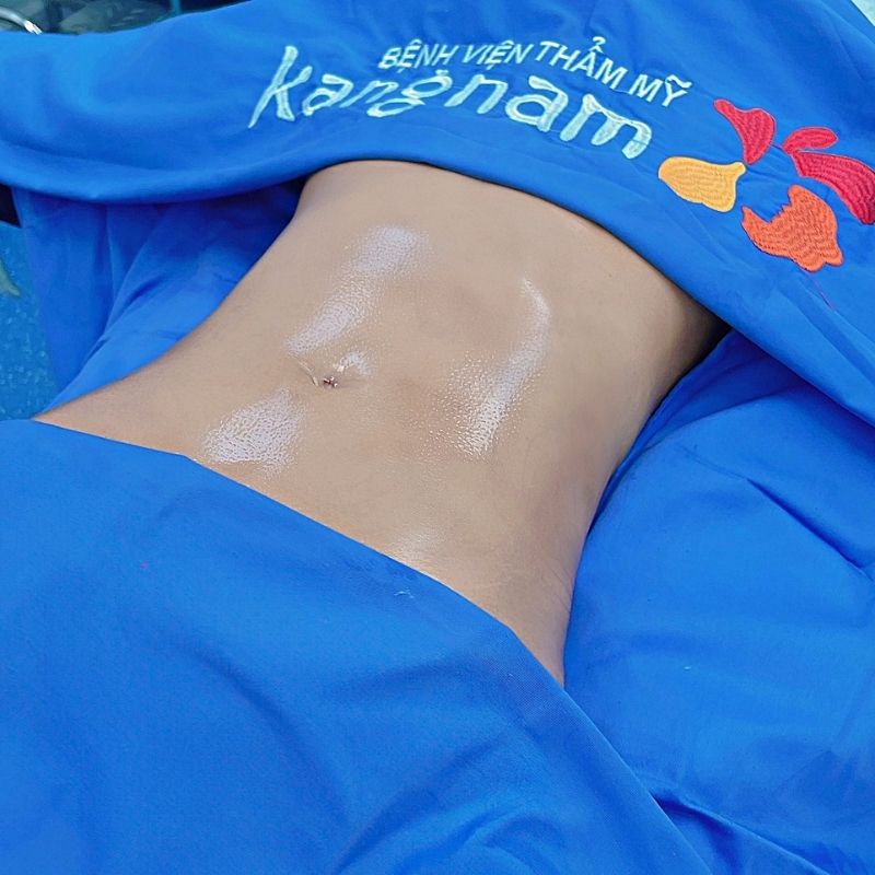 Làn da săn chắc sau khi giảm mỡ