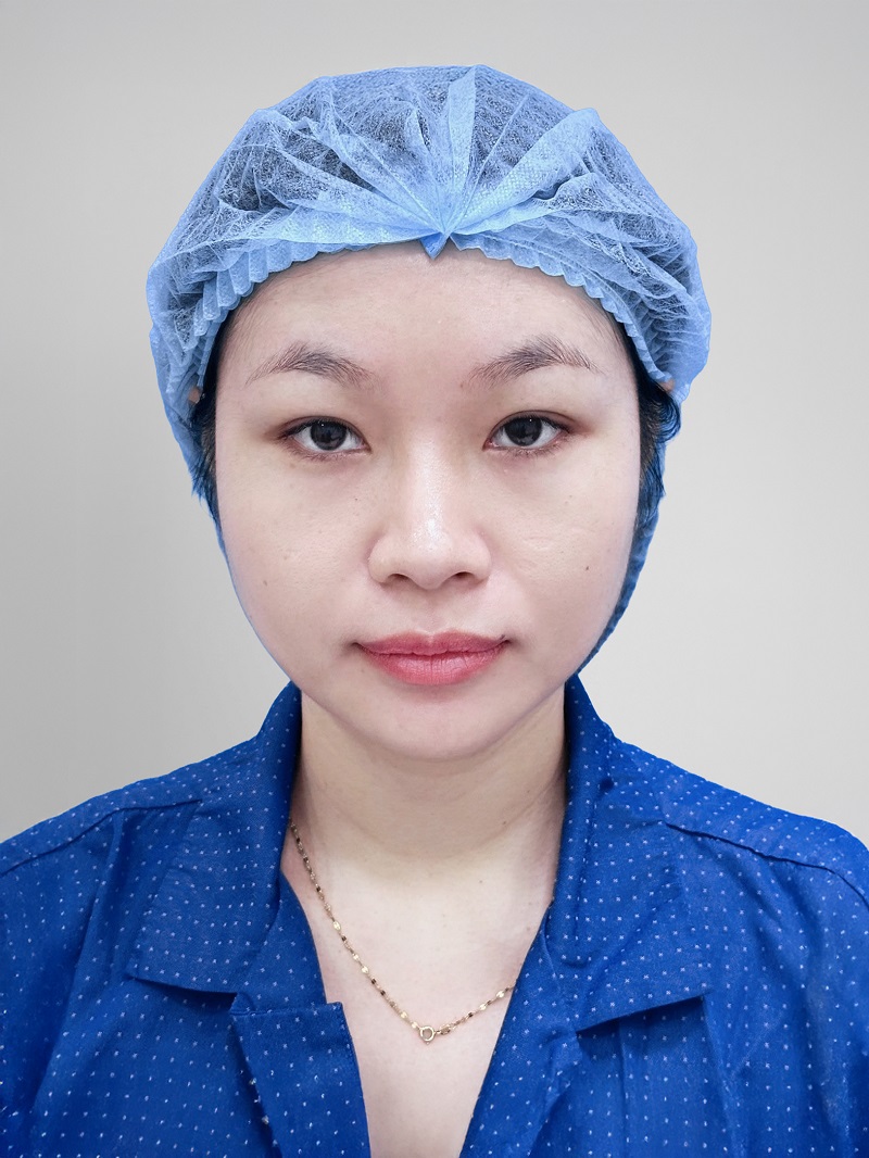 Tình trạng mí sụp không rõ nếp mí