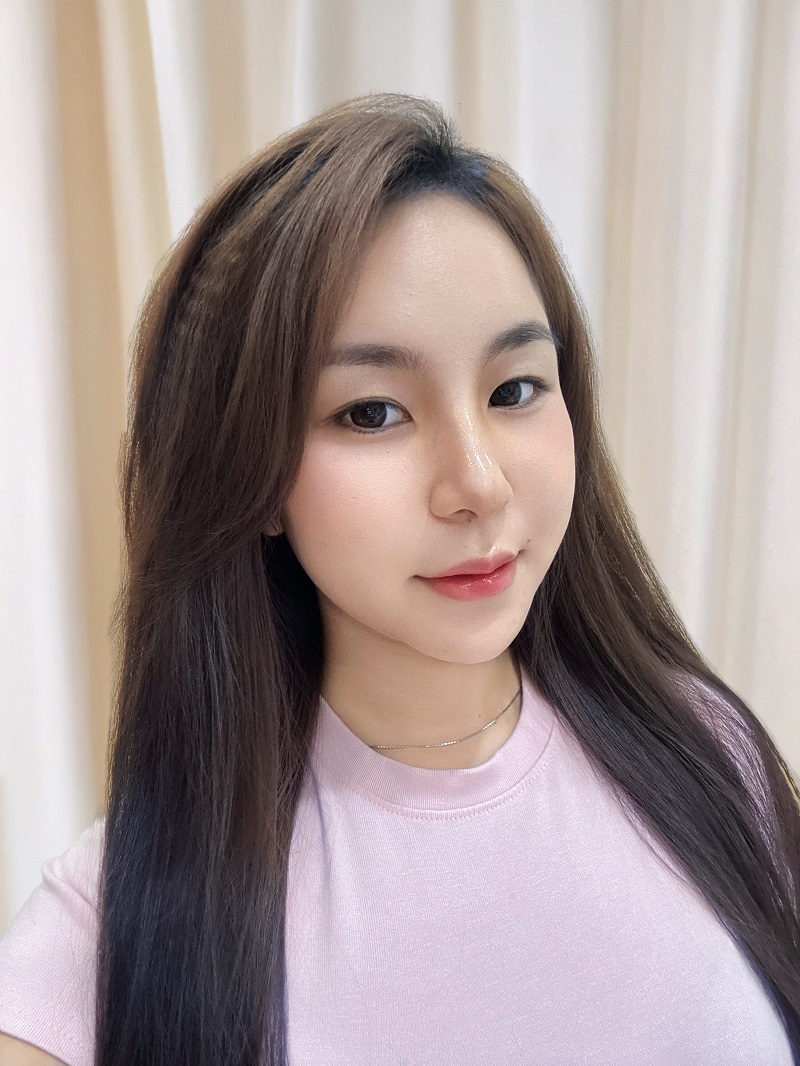 Sau 7 ngày mũi vào form, đẹp tự nhiên