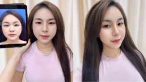 Gia Ân “thăng hạng nhan sắc” ngoạn mục sau nâng mũi tại Kangnam Sài Gòn