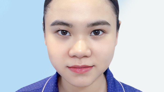 Đầu mũi tròn là gì? Đặc điểm nhận biết, nguyên nhân và cách khắc phục