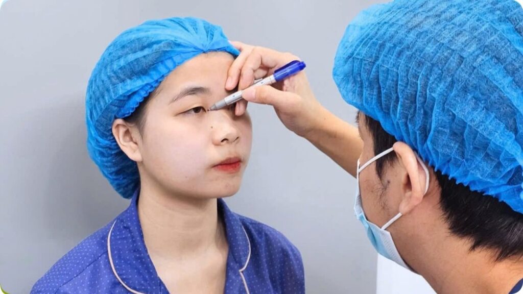 Ai nên cắt mí? 5 trường hợp nên cân nhắc cắt mí