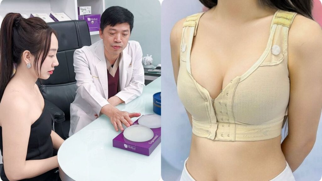 Các phương pháp nâng ngực hiện nay: Nên chọn túi ngực hay mỡ tự thân?