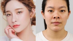 Cách nhận biết các dáng mũi phổ biến trên khuôn mặt