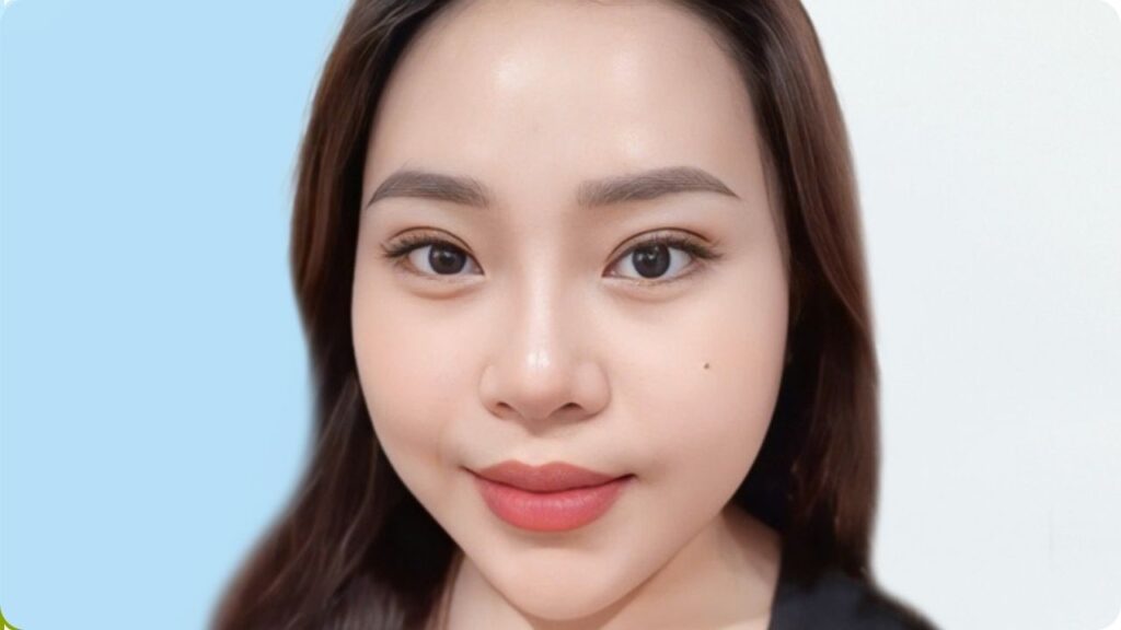 Cắt mí bao lâu thì hồi phục? Thời gian lành, hết sưng và sinh hoạt bình thường