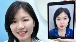 Cắt mí có tự nhiên không? Sự thật về kết quả, độ bền và thay đổi sau thời gian