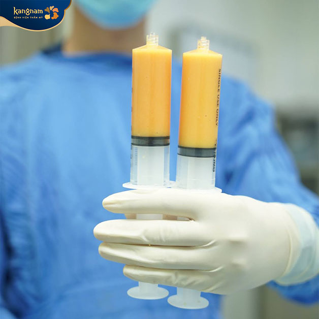 Cấy mỡ làm đẹp ngày càng được nhiều khách hàng ưa chuộng