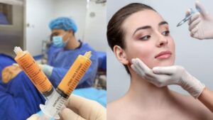 Cấy mỡ tự thân có hiệu quả không? Có thay thế filler không?