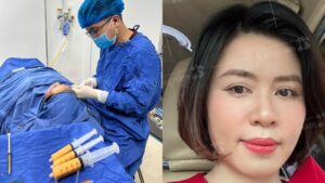 Cấy mỡ tự thân ở đâu uy tín tại TP.HCM? Cách so sánh các cơ sở trước khi lựa chọn