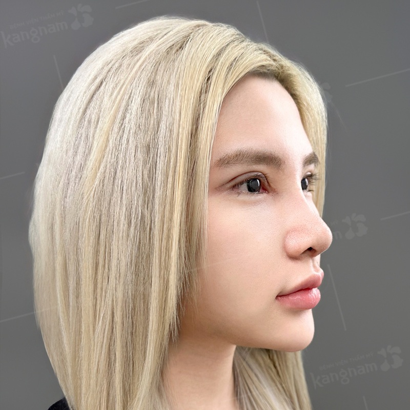 Mũi vào form ổn định