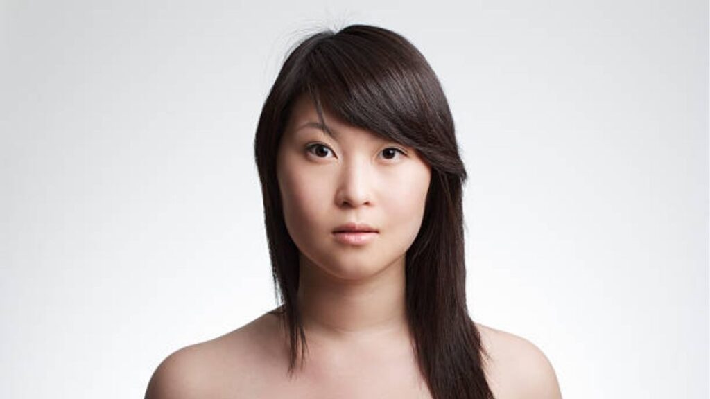 Chỉnh hàm lệch là gì? Nguyên nhân, dấu hiệu và cách điều trị mặt lệch