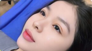 Có nên cắt mí, nhấn mí không? Có hại hay nguy hiểm không?