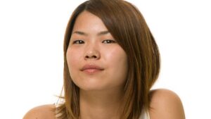Độn cằm tròn là gì? Phương pháp thực hiện, độ bền và chi phí