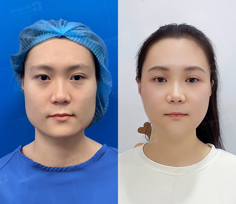 Hàm to, vuông ưu tiên thực hiện cơ sở uy tín