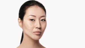 Gọt mặt V line là gì? So sánh với Botox và các phương pháp thon gọn mặt