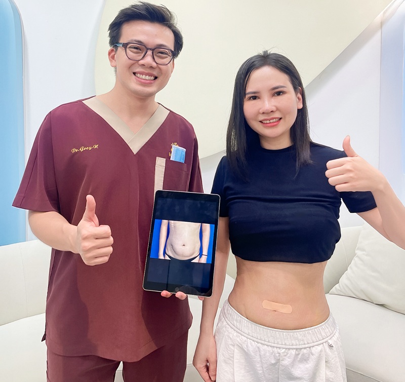 Có hình ảnh khách hàng thực tế hút mỡ