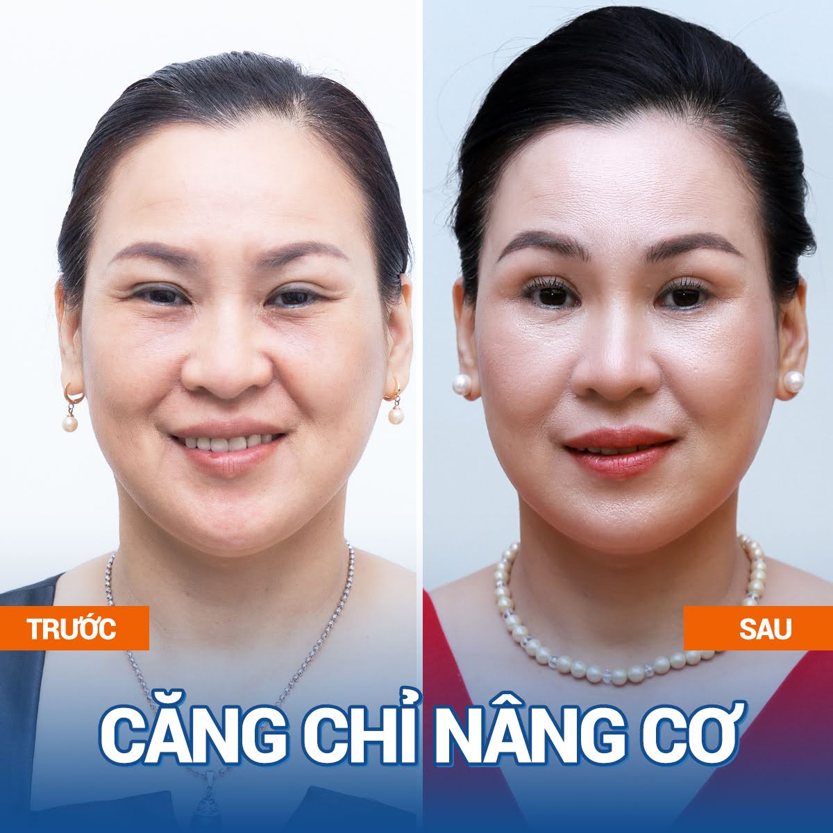 Da chảy xệ, lão hoá được cải thiện rõ rệt