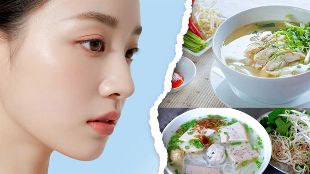 Nâng mũi ăn bún được không? Giải đáp từ chuyên gia