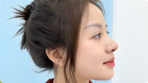 Nâng mũi bao lâu thì ổn định? Thời gian hồi phục và cách chăm sóc