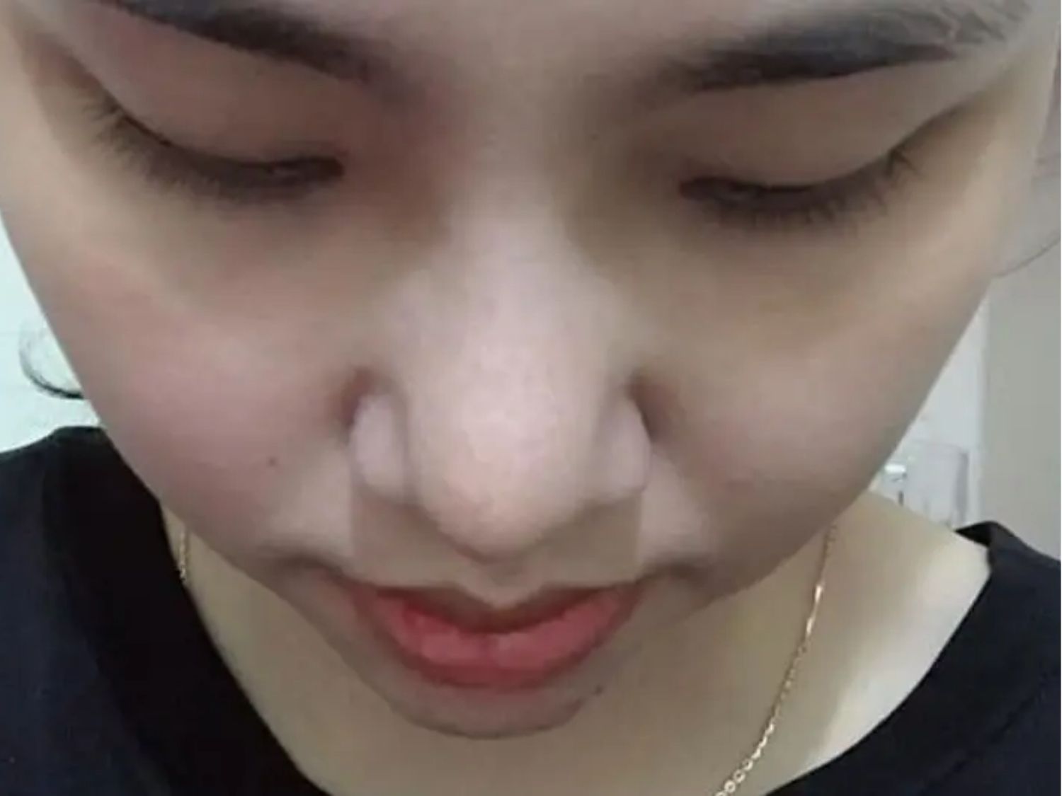 Mũi trông mềm hơn