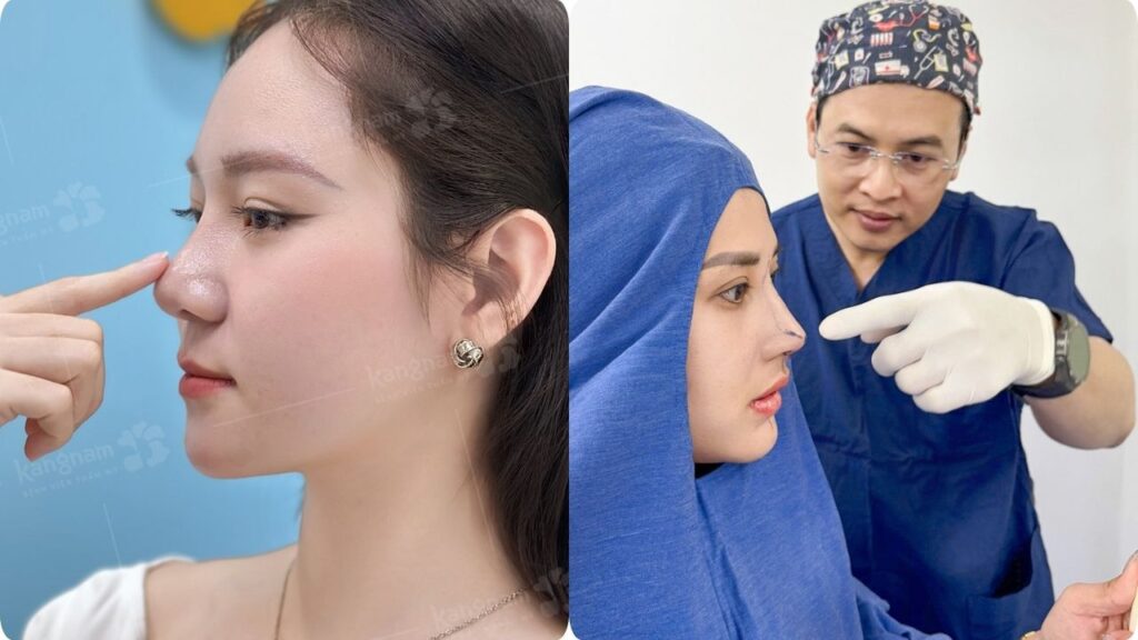 Nâng mũi tại Kangnam Sài Gòn – Bác sĩ chuyên sâu, ca đẹp thực tế