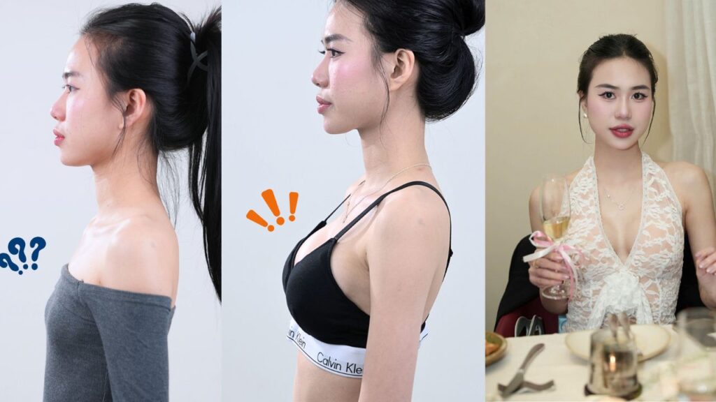 Nâng ngực ở đâu đẹp TP.HCM? 5 tiêu chí đánh giá địa chỉ nâng ngực uy tín