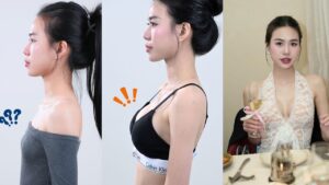 Nâng ngực ở đâu đẹp TP.HCM? 5 tiêu chí đánh giá địa chỉ nâng ngực uy tín