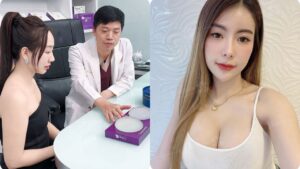 Nâng ngực tại Kangnam Hà Nội – Địa chỉ nâng ngực an toàn, chuẩn y khoa