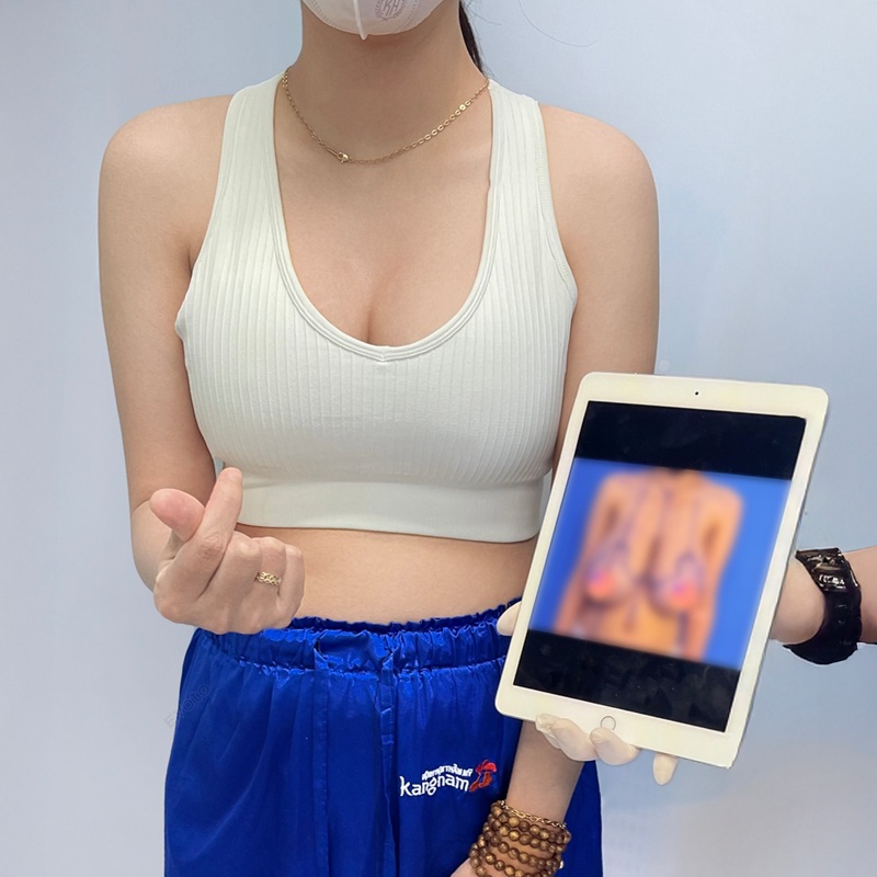 Nâng ngực Nano cải thiện vòng 1 săn chắc, bùng cháy