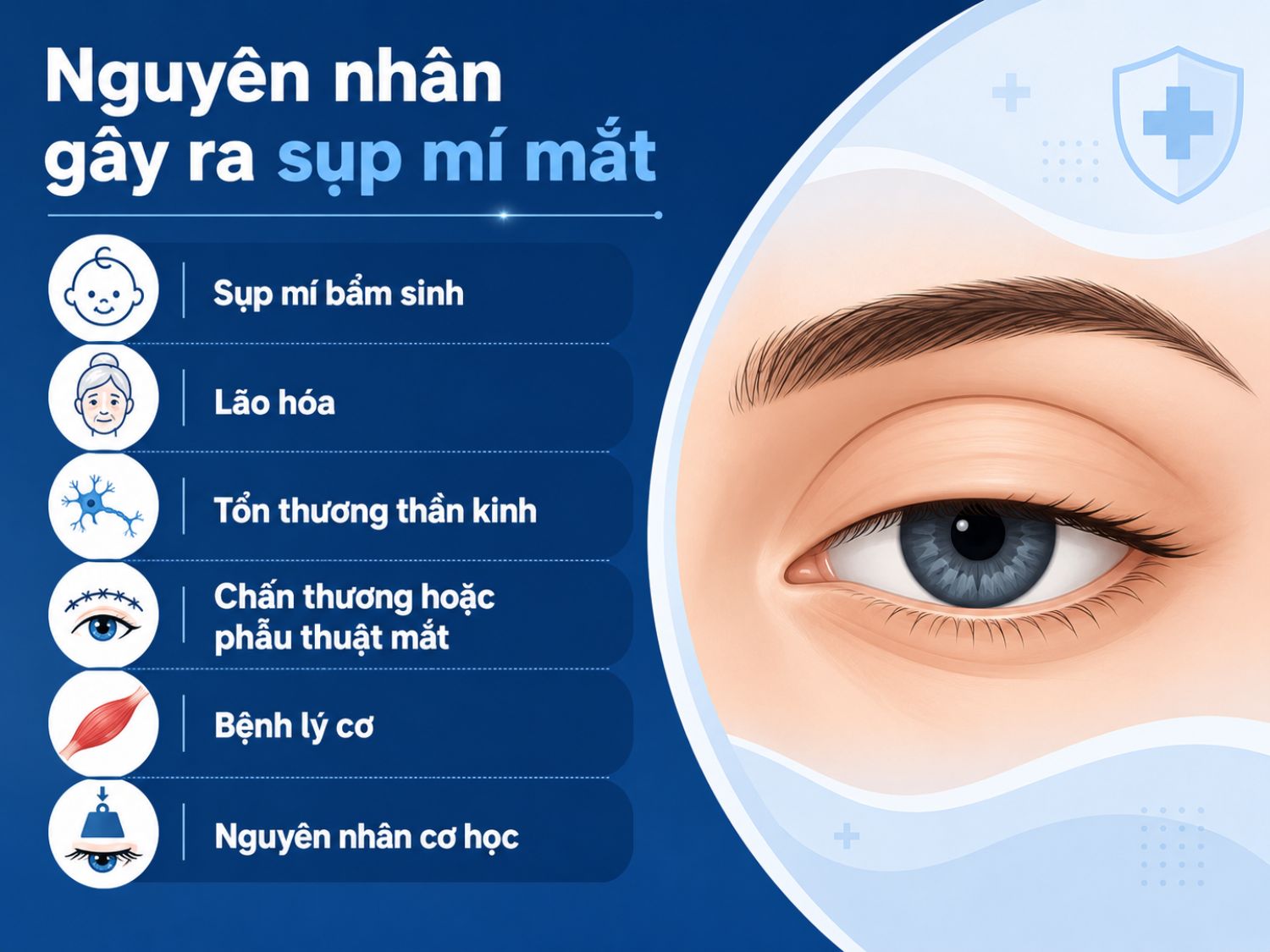 Sụp mí mắt có thể xuất phát từ nhiều nguyên nhân như yếu tố bẩm sinh, lão hóa, tổn thương thần kinh, bệnh lý cơ, chấn thương – phẫu thuật vùng mắt hoặc các tác động cơ học làm mí trên sa xuống.