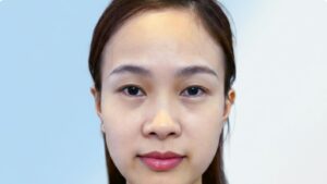 Ai nên cắt mí? 95% khách hàng lột xác nhờ xác định đúng đối tượng