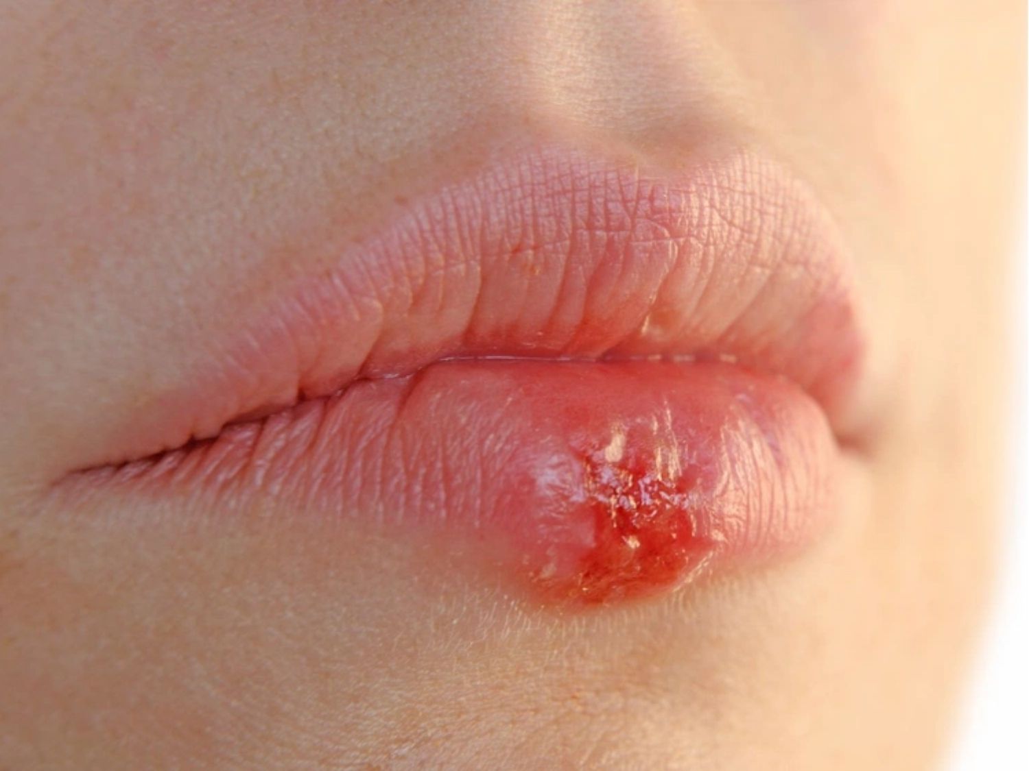 Vùng da đang có vết xước