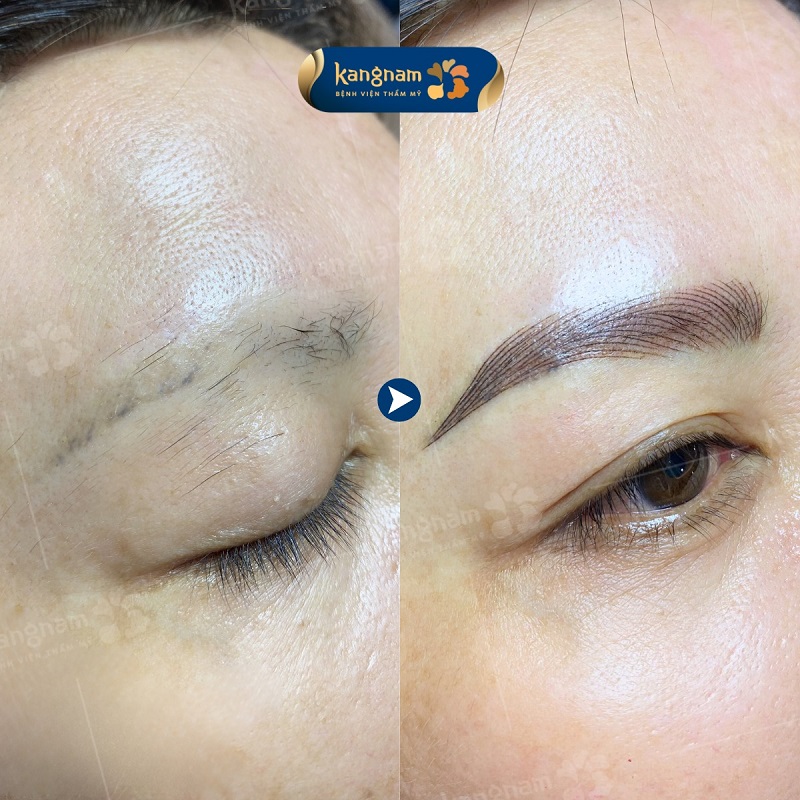 Dịch vụ phun xăm chất lượng cao và an toàn